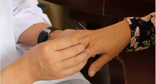 环球在线新闻&nbsp;大理州宾川县大型义诊活动首日，“黄帝内针”在宾川县中医院如期开诊现场上演！